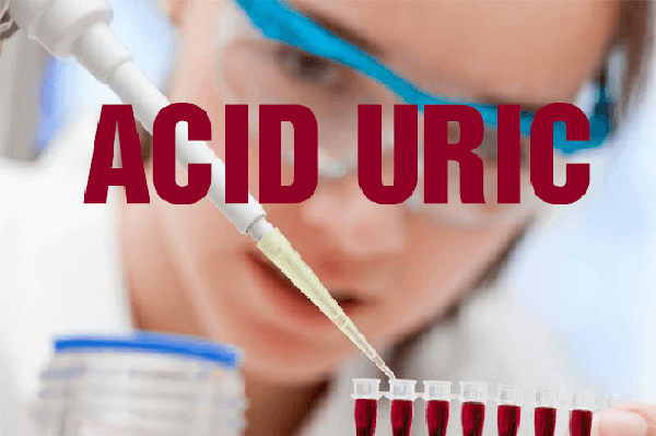 Chỉ số acid uric và bệnh lý liên quan
