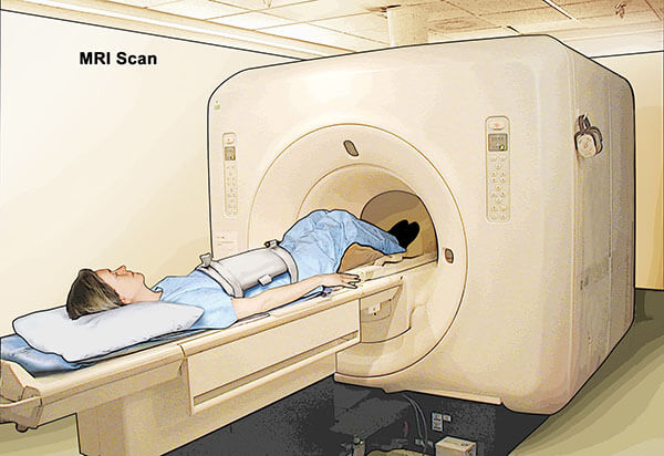 Hình ảnh chụp MRI