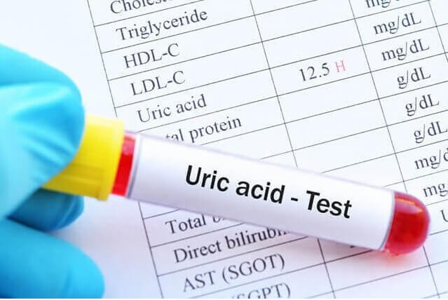 Nồng độ acid uric cần đưa về khác nhau ở từng tình trạng bệnh