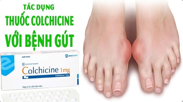 Tác dụng của colchicin đối với bệnh Gout