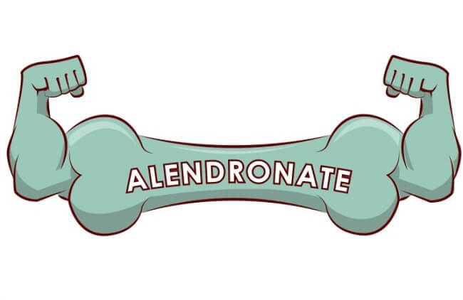 Thận trọng khi sử dụng thuốc alendronate cho người bệnh loãng xương