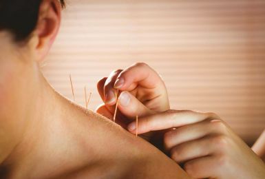 Phương pháp châm cứu chữa đau lưng là gì?
