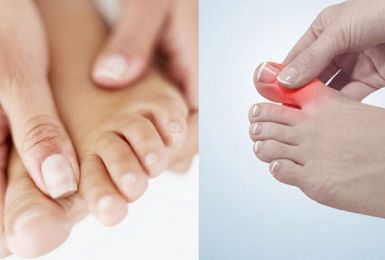 Sưng ngón chân cái có phải dấu hiệu bệnh xương khớp nguy hiểm?