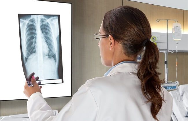 Chi phí chụp X-quang rẻ hơn nhiều so với kỹ thuật chẩn đoán hình ảnh khác