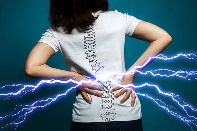 Đau lưng là triệu chứng đặc trưng điển hình của bệnh thoát vị đĩa đệm thắt lưng
