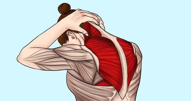 Căng cơ là nguyên nhân chủ yếu gây ra hiện tượng đau cứng cổ sau khi ngủ dậy