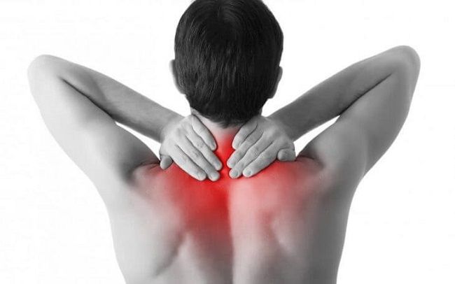 Căng cơ là nguyên nhân phổ biến gây đau cổ vai gáy bên trái