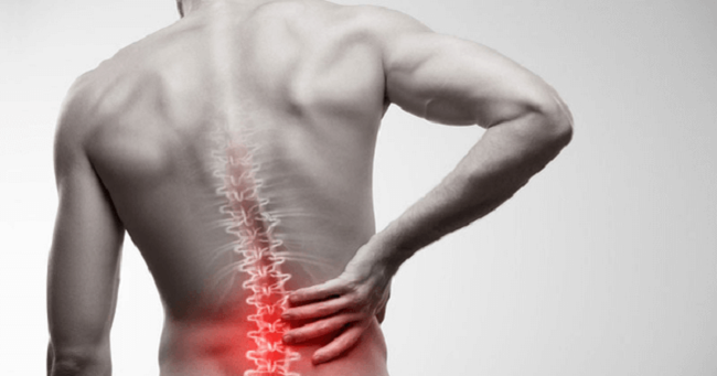 Đau lưng là dấu hiệu cảnh báo của nhiều bệnh, trong đó có xẹp đĩa đệm thắt lưng