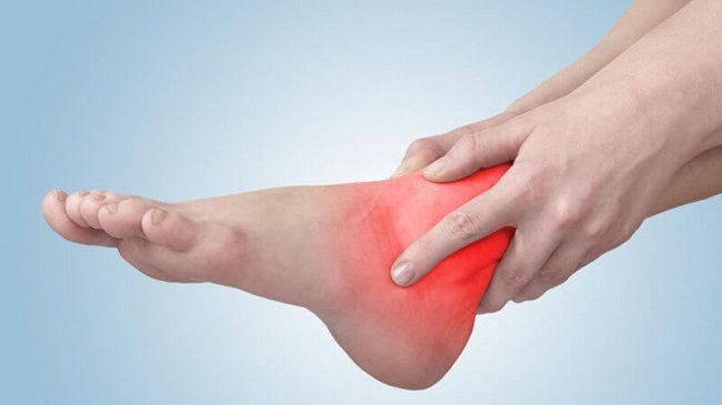 Bệnh gout gây ra các cơn đau dữ dội hoặc dai dẳng tại các khớp chân
