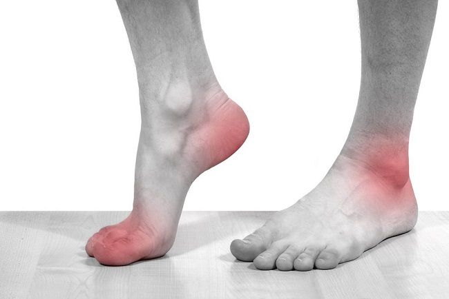Bệnh gout thường gây ra các vấn đề tại nhiều khớp chân