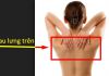 Đau lưng trên là bệnh gì? Nguyên nhân và cách điều trị tận gốc