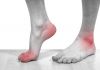 Dấu hiệu bệnh gout ở chân giúp bạn nhận biết sớm mối nguy hiểm